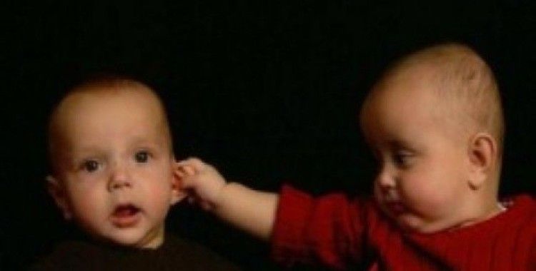  Rüyada çimdik görmek ne demek ? 