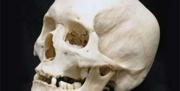 Rüyada kafatası görmek