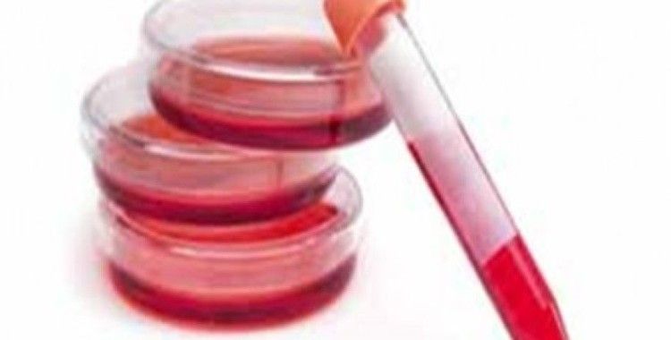 Rüyada kanı görmek