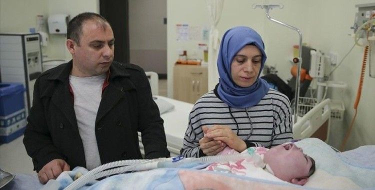 Anensefali hastası bebek azmiyle doktorları bile şaşırtıyor