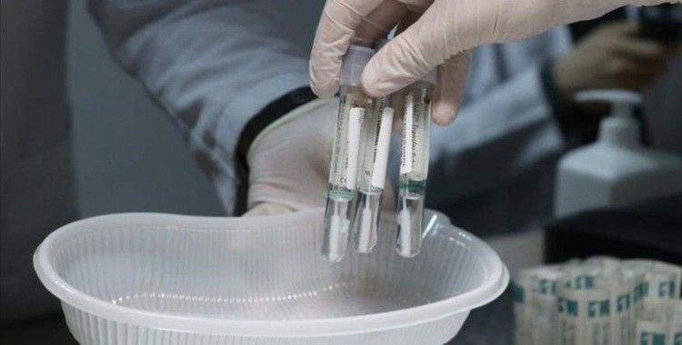 THY'den 'PCR test raporu' açıklaması