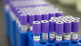 İngiltere’de 12 kanser türünü erken saptayan kan testi deneniyor