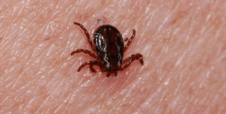 Sivas'ta KKKA hastalığı şüphesiyle tedavi gören kişi öldü