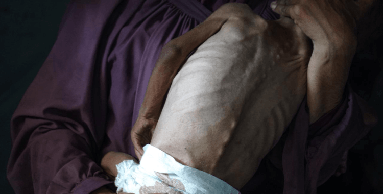 Gazze'yi kıtlığa sürükleyen İsrail, Güney Sudan'a "insani yardım" yapacağını duyurdu