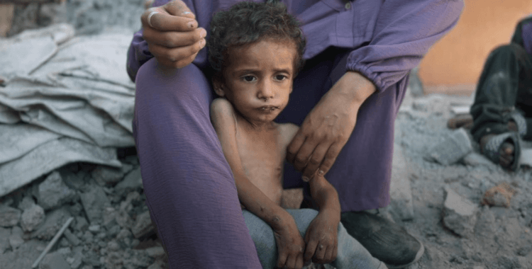 DSÖ: Gazze'de sadece bu yıl yetersiz beslenme nedeniyle 206 kişi öldü