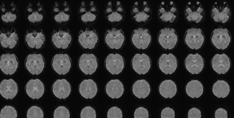 Zihin okuma artık mümkün mü? Japonlardan yeni keşif