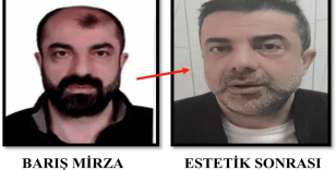 Türkiye'ye girerken yakalandı: Firari cinayet zanlısının ameliyatla yüzünü değiştirdiği ortaya çıktı